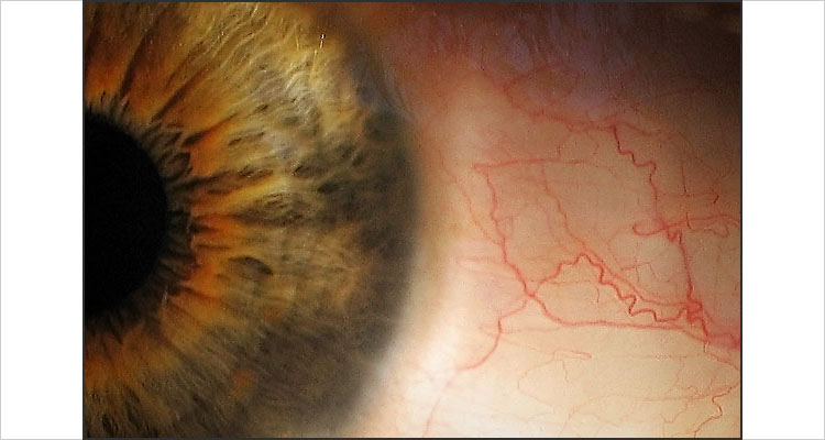 Canon G3 | 1/15s | F4.5 | ISO 100